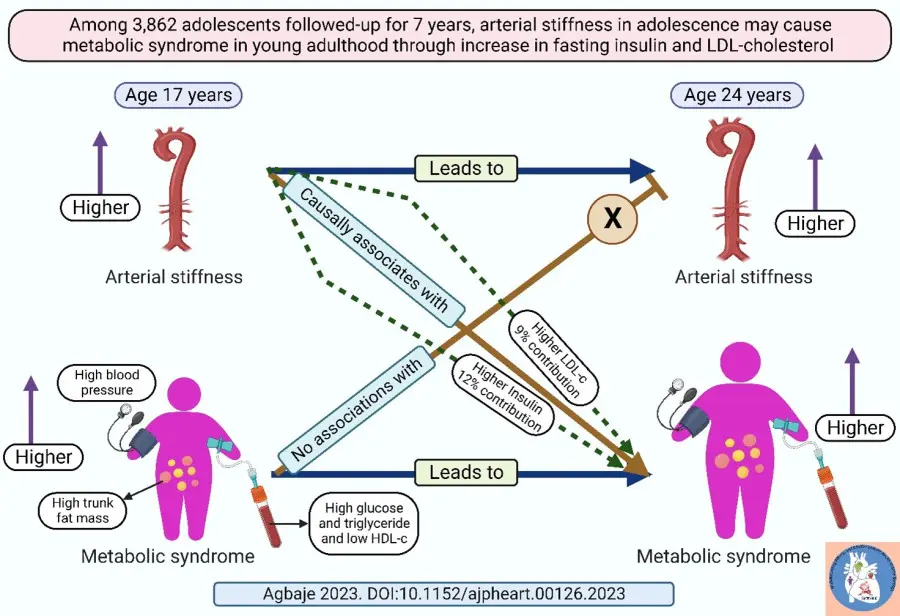 Arterial stiffness may cause metabolic syndrome in adolescents via an increase in fasting insulin and LDL-​cholesterol